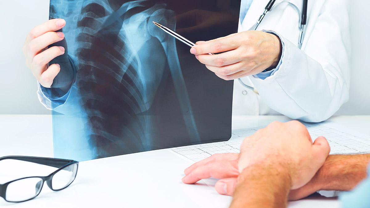 Metallentfernungen - Arzt zeigt mit Stift auf ein Röntgenbild